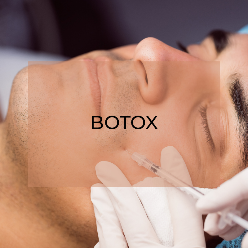 Non-surgical Botox